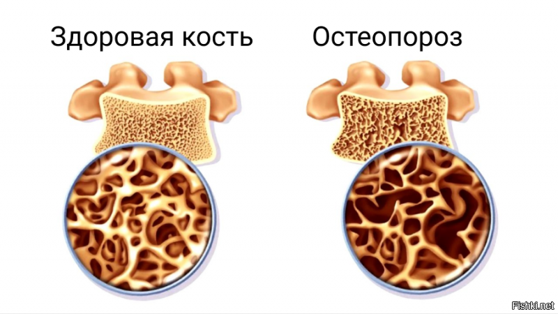 А при чём тут химия то?)) Если кальций природный элемент содержащийся в природных компонентах........

Можешь просто больше молочных продуктов потреблядь......можешь обычный школьный мелок есть.....Разницы никакой......

А из-за недостатка кальция и развивается хрупкость костей в возрасте.......

Другое дело гибкость суставов.....но и тут помогут обычные вещи.....