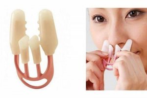 Выпрямитель носа