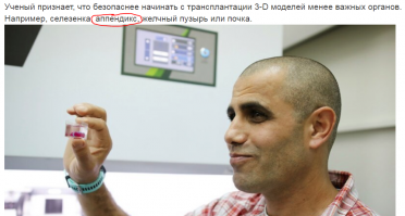 Чо, реально будут аппендикс пересаживать?:)