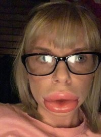 - Мы с поручиком Ржевским катались на лодке и вдруг, откуда ни возьмись - оса!
Села мне прямо на губу.
- Так это оса вас так ужалила?!
- Нет, не успела, поручик её веслом убил.