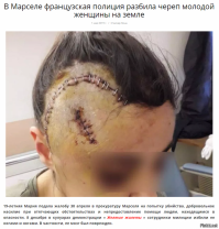 Вонючая либерасня питоросня, хотите как в ПарЫже?
На Колыму вас всех гнид.