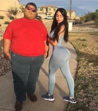 Парень знаменитость, он единственный в мире, у кого попа спереди. А девочку в губы, скулы и жопу - осы покусали.