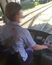 У меня два вопроса: что у неё с лицом и не заразно ли это?