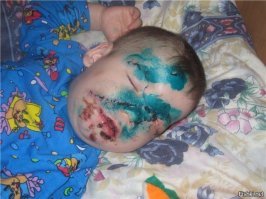 Догхантершу из Санкт-Петербурга накормили собственной отравой