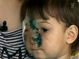 Догхантершу из Санкт-Петербурга накормили собственной отравой