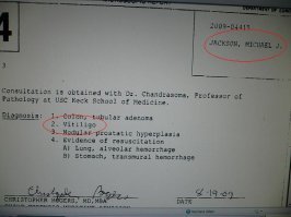 Он 25 лет пытался остановить витилиго.