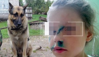 Это касается тех фото,где здоровые собаки без намордников.