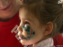 Это касается тех фото,где здоровые собаки без намордников.