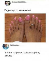 То то я смотрю ,большой палец на руке как то не так растёт