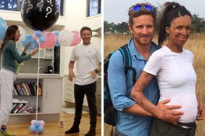 как ей с такими ожогами удалось выжить??!!