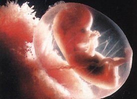 Вот достали уже с молодым Якубовичем. Нате вот смотрите и закрывайте уже тему.