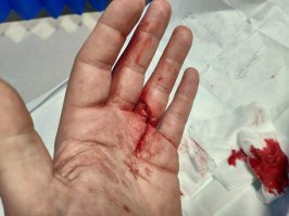 Я столкнул кружку со стола. Но у меня хорошие рефлексы, и я её поймал. При этом, стукнув об угол кухонного шкафчика.