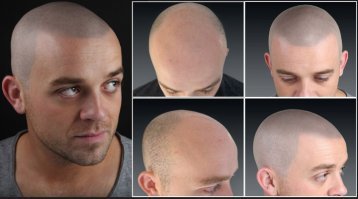 Сюрприз будущей жене от любящего, но стремительно лысеющего мужчины