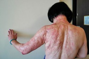 Истории самых известных фотографий 20 века: Напалмовая девочка