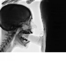 Мир глазами рентгенолога