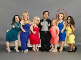 На фото у всех лица такие, как описаны в посте, за исключением одной девушки. Реально красотка. Жалко, что ее постигла такая болезнь. Ну их всех жалко, конечно.