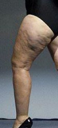 Не всю, некоторую часть.