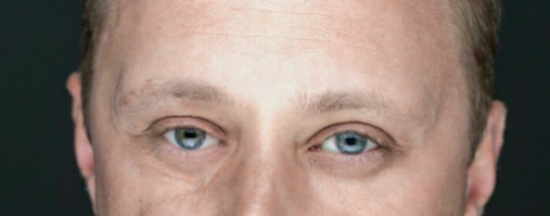 Загадка: 
Угадай, где стеклянный глаз?