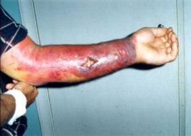 Плять что вообще происходит? Они зная как это опасно спорят в суде из-за 500 штук.Это куйня  почти тоже самое что бактериологическое оружие .  Это даже не дебилизм потому что они  сами там живут. Им фото перед едой что-ли показывать. Болезнь протекает сверх быстро что еще нужно. Взять колбу в мэрии рассыпать?