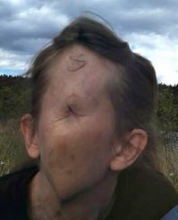 Это когда говорят - вместо головы жопа!
