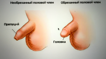 А как же эта процедура?