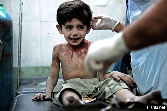 Смерть этого 3-летного сирийского мальчика потрясла мир. Это он на своей последней фотографии из больницы, куда его привезли врачи после сильных ранений с многочисленными внутренними кровоизлияниями.

Перед смертью он успел сказать: «На всех вас пожалуюсь Богу, всё Ему расскажу!»

Вот она, ваша кровавая ЖАТВА! Вот она   страшная дань, которую МЫ, ЛЮДИ, платим вам, ненасытным людоедам! Это уже давно не ритуальное, а экономически обоснованное жертвоприношение на алтарь вашей выгоды и благополучия.

Вы давно сошли с ума от крови ваших жертв, вы пьяны чужим горем, чужой болью! Это, вы, нелюди, ТАК правите миром!

Это ваш бал сатаны, не иначе!

Бал, на котором вы объявляете танец за танцем, на пути в преисподнюю!

И не важно, что вы не всегда творите злодеяния своими руками, чаще всего вы натравливаете народ на народ, брата на брата, сына на отца.

Так каким же Богом вы избраны?! И для чего?!

На протяжении всей истории нормальные люди гнали вас от себя! И проклинали! Проклинают! И будут проклинать!