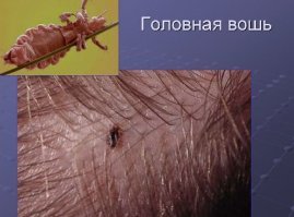 Индийский лекарь не мыл волосы 40 лет по велению бога