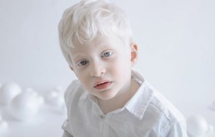 15 животных-альбиносов, которым белый идёт даже больше, чем естественный цвет