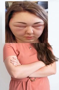 Если предположить, что девушка носит шапку XL, то диаметр ее головы составляет ~19 см. 
Увеличив не в "несколько" раз голову, а всего лишь в 2 раза, получим диаметр головы ~40 см
Получается не совсем человек или автору заголовка нужно покрасить волосы