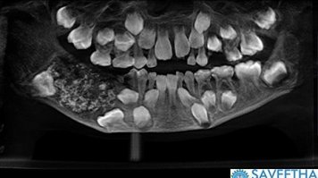 Погуглила. Вот, что нашла . РИА Новости