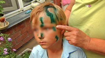 -"Благо, что в последние года с ними работают по определенной системе «отлов-стерилизация-вакцинация-выпуск»"- 
вот им расскажи про "благо".Лично я за отстрел всех шавок без намордников и поводков.