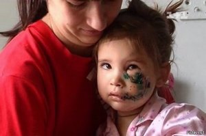 -"Благо, что в последние года с ними работают по определенной системе «отлов-стерилизация-вакцинация-выпуск»"- 
вот им расскажи про "благо".Лично я за отстрел всех шавок без намордников и поводков.