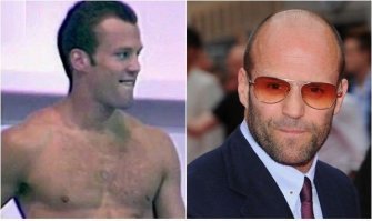 Лысые с волосами