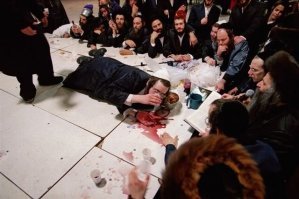 Гастрономический загар, или как распознать алкоголика по внешнему виду