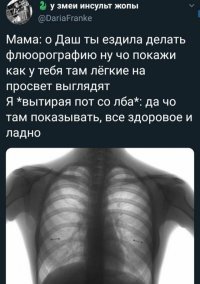 Сколько уже раз вижу эту картинку. ОБЪЯСНИТЕ В ЧЕМ ТУТ ПРИКОЛ??