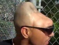 Бывают ли люди без мозгов?