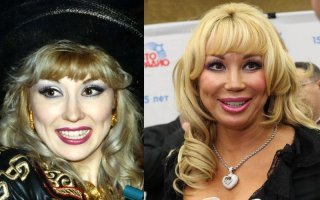 Фото с Распутиной неправильное. На первой фотке она уже после пластики.
До пластики она была другая