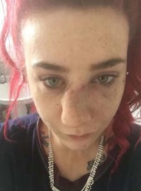 Вот сломан нос, а тут хрень какая та