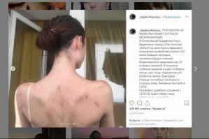 Как человек видевший шрамы от ножевых ударов и имеющий аналогичные, могу с высокой долей уверенности сказать, что эти шрамы не от проникающих ножевых ранений... 
Можете закидать меня с ног до головы какахами, но это не ножевые.