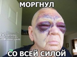 Почему появляются синяки на ногах?