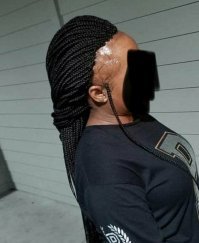 Что у него с лицом?