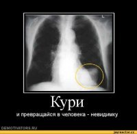 ох как это трудно бросить курить, ох как трудно, но НАДО б-л-я-ть!