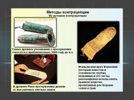 Меня больше умиляют древние презервативы.
Как понимаю - из меди :)