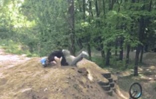 Интересно, сколько всего переломов у людей здесь запечатлённых?