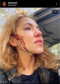 А вот это блохерша наверно телефон бы достала...