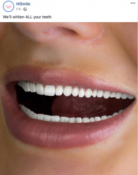 Количество зубов под названием - мечта стоматолога