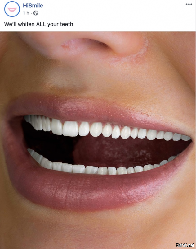 Количество зубов под названием - мечта стоматолога