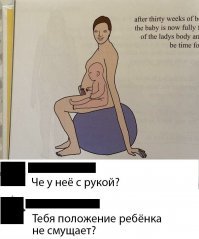 С экрана монитора УЗИ на мать посмотрели огромные глаза