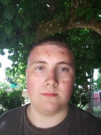 Ну зачем такую жесть постить-то?
Вокруг дети и женщины ходют!
Это всё-таки развлекательный сайт, а не сайт с чернухой и жестью!
За это фото однозначно минус!!!