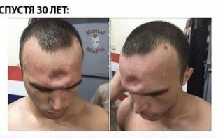 Страшно подумать, что было бы при неправильном положении плода.